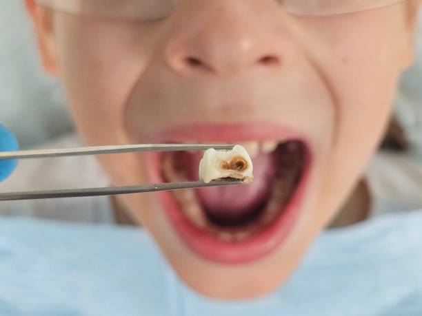 Best Pediatric Emergency Dentist in Hemphill, TX